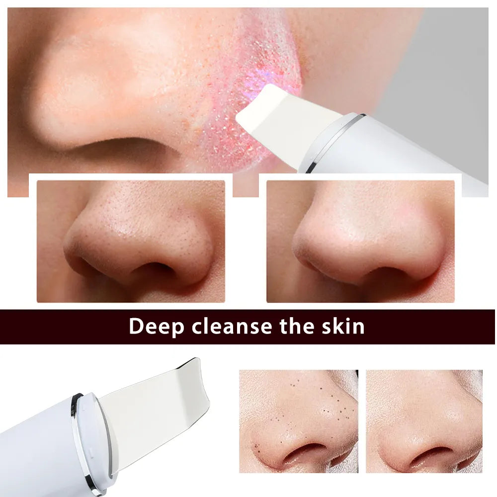 Ultrasonic Skin Scrubber Facial EMS Spatula